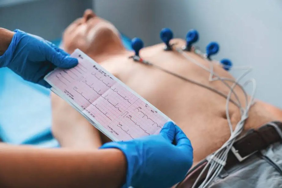 Electrocardiógrafos Mortara