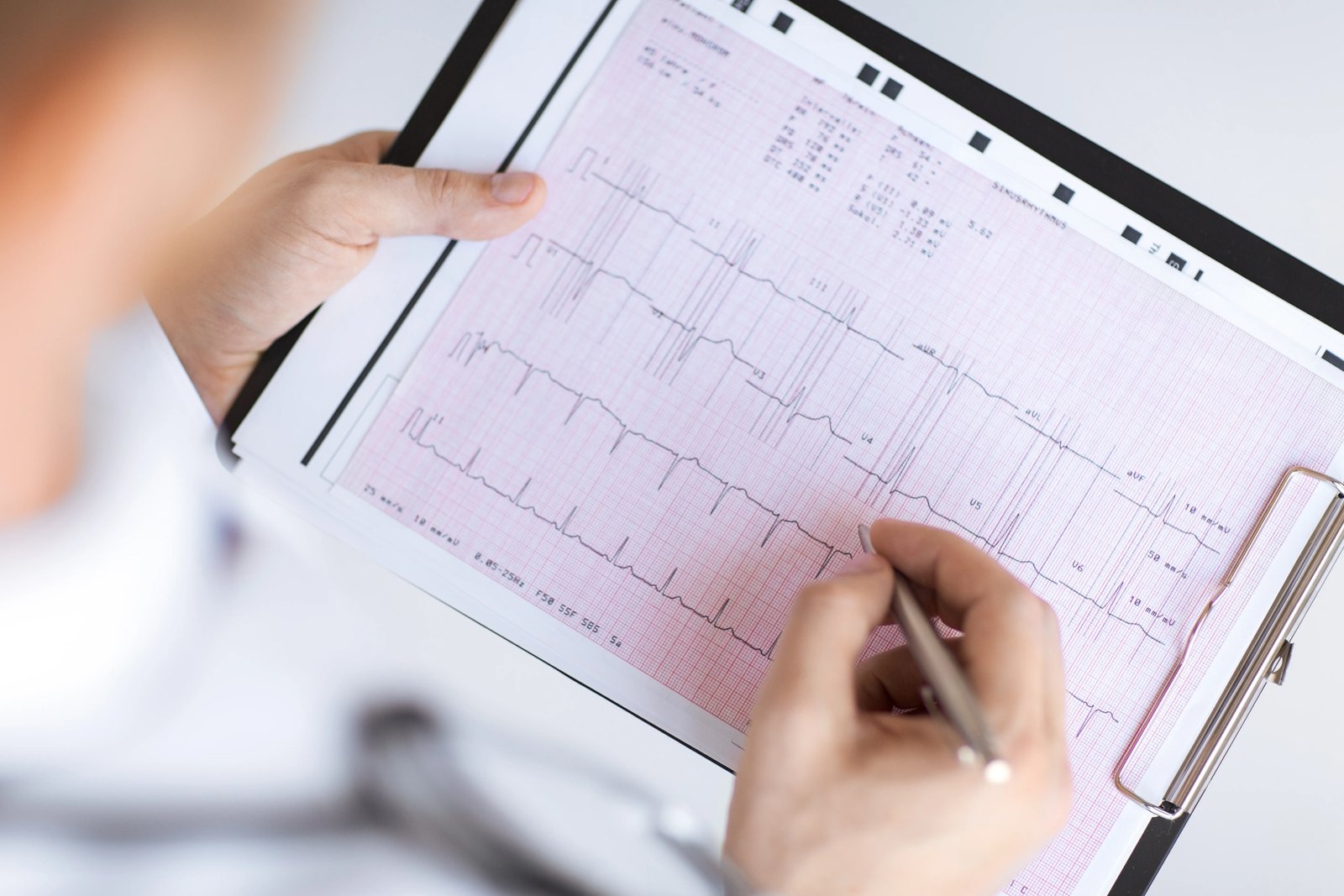 Médico revisando un electrocardiograma impreso